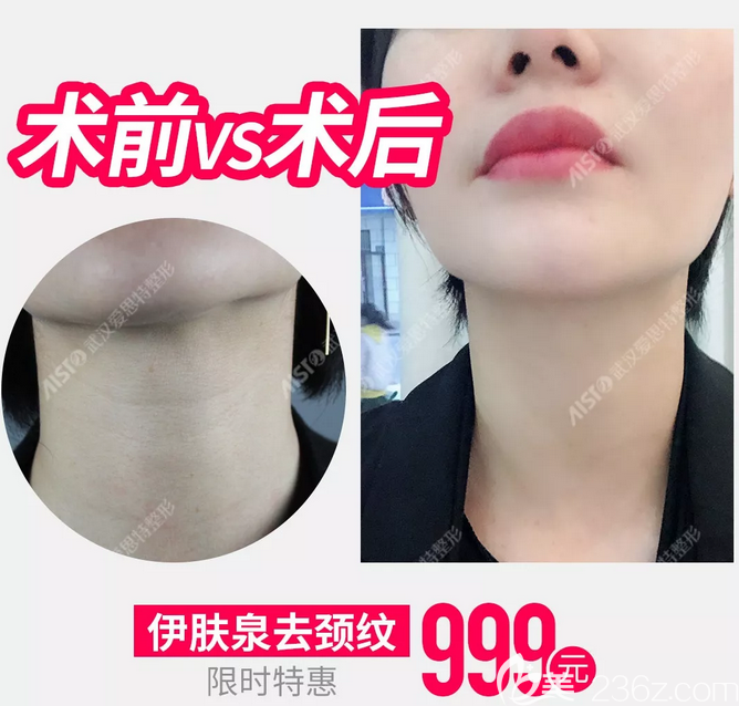 玻兰人口(3)