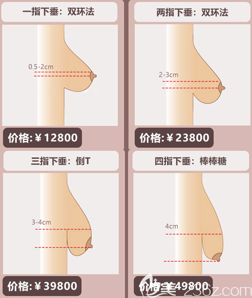 姚成红医生针对胸部乳房下垂手术,姚成红医生会根据顾客的乳房下垂