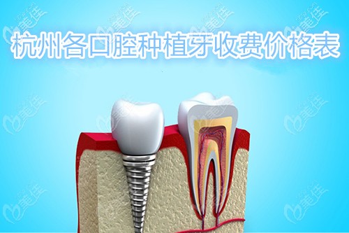呕心整理出这份杭州各口腔医院的进口种植牙价格表!