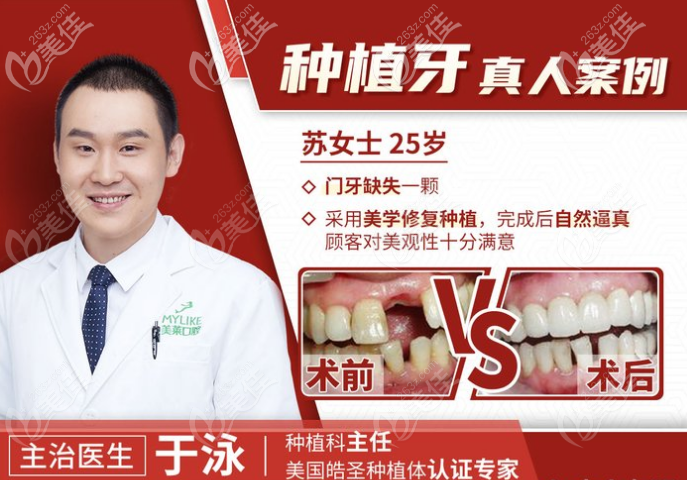 深圳美莱口腔种植牙怎么样分享美莱口腔种植牙医生种牙价格
