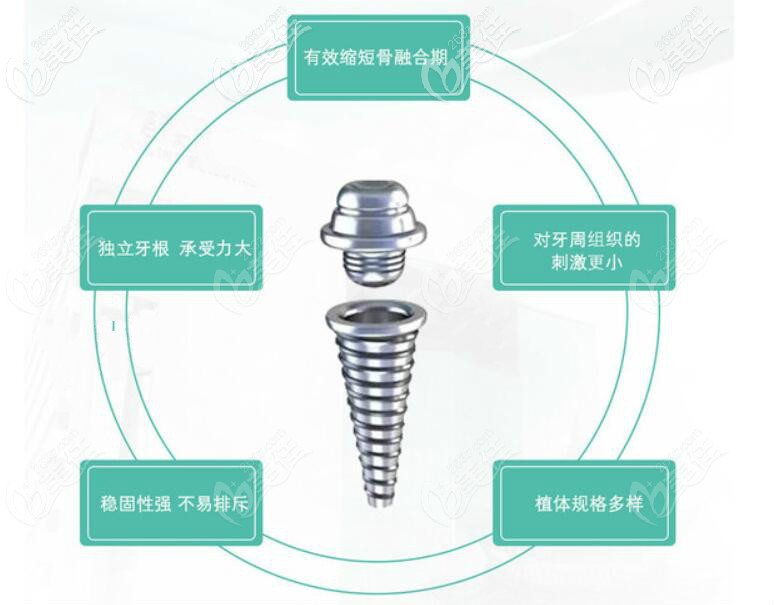 包含的品牌种类也多,其中登腾,奥齿泰,美格真这三种是韩国种植体主流