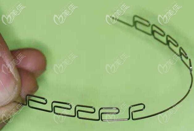 简单,自己本身就带有弧度,而方丝弓矫治器是多带环固定矫治器的一种