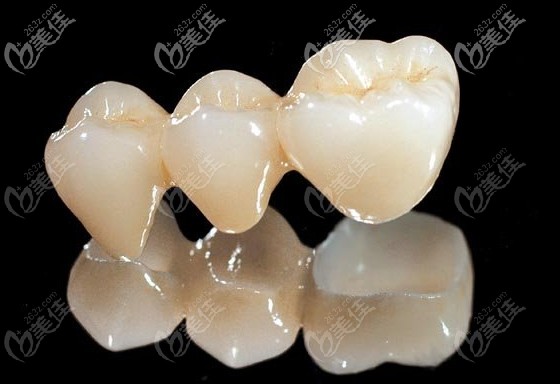 缺牙人牙齿固定桥修复和种植牙哪个好各自利弊讲清楚
