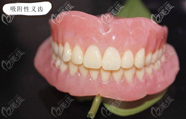 在修复科,口腔医生经常被问到"吸附性义齿和普通义齿有啥区别",今天