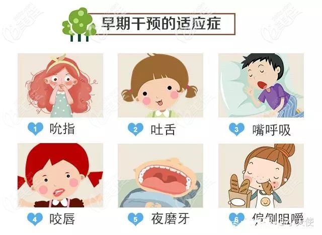 儿童早期干预的肌功能矫治器品牌汇聚mrc罗慕etauc等