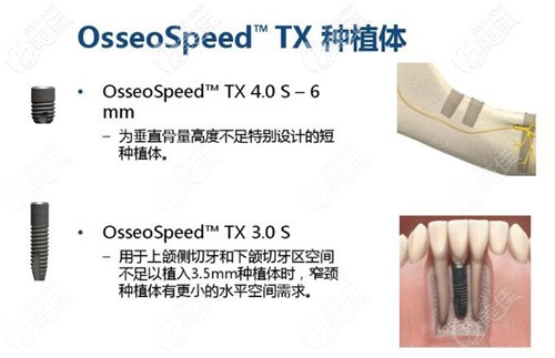 植体跟骨头结合,是依附于血