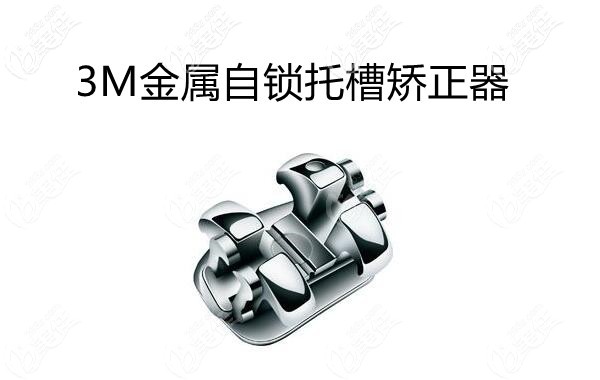 3m自锁金属正畸托槽有几种型号其和9000元的国产托槽区别在哪