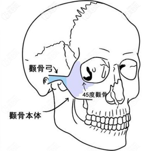 颧骨的位置
