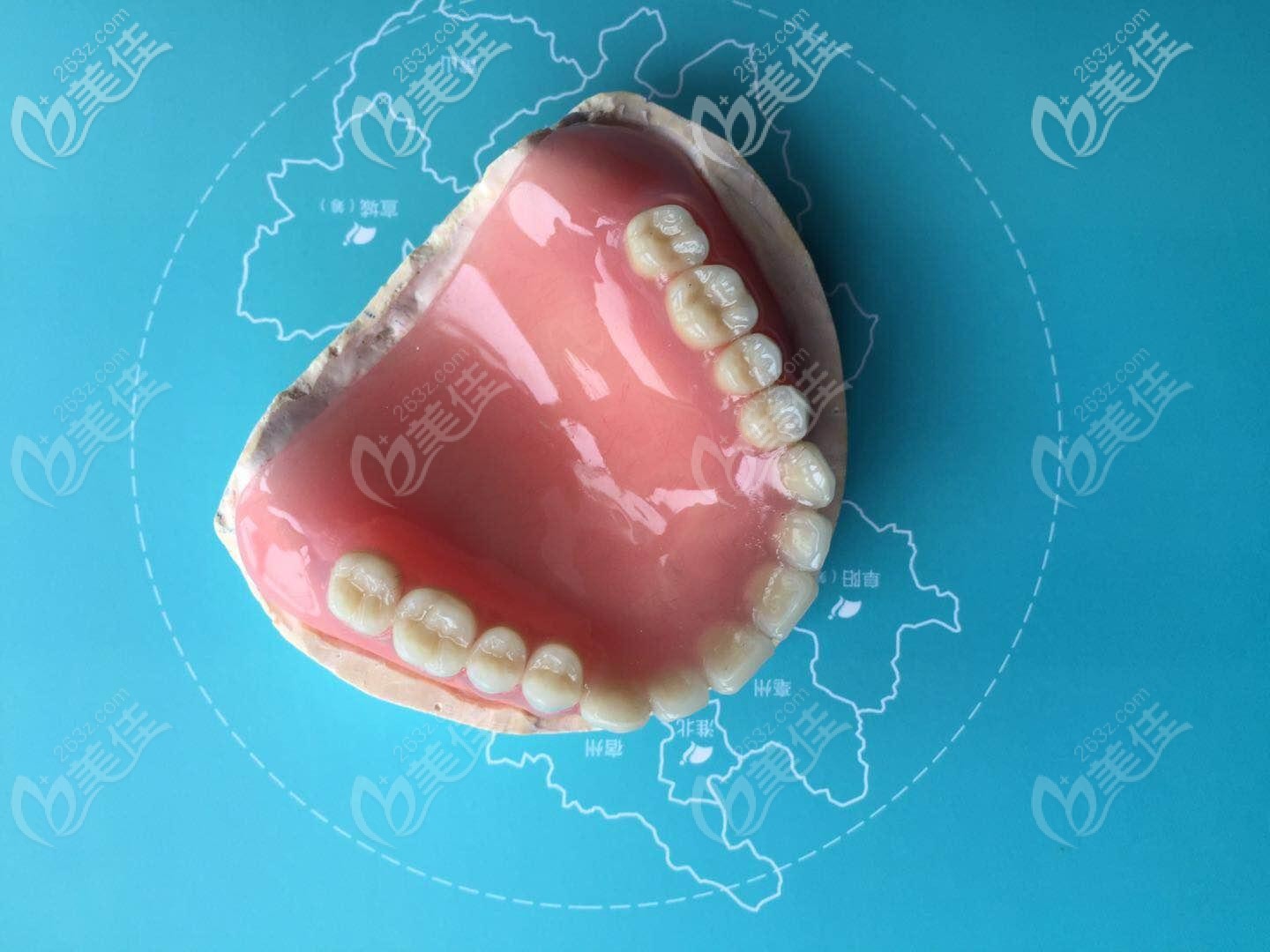 30岁半口牙缺失采用什么修复方式好?能做纯钛吸附性义齿吗?