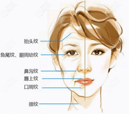面部衰老问题
