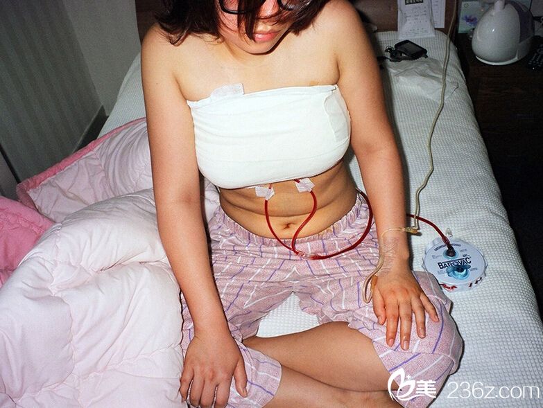 摄影师拍韩国女子整容后恢复期真实照片(组图)