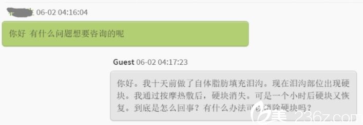 自体脂肪填充面部后出现硬块