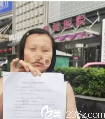 自体脂肪填充面部后凹凸不平