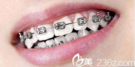 西京医院牙齿正畸治疗