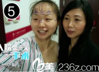 妹子在广州华美医院阮庆玲医生那里做双眼皮手术前和妈妈的合照
