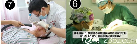 广州华美医院阮庆玲医生做双眼皮手术过程图