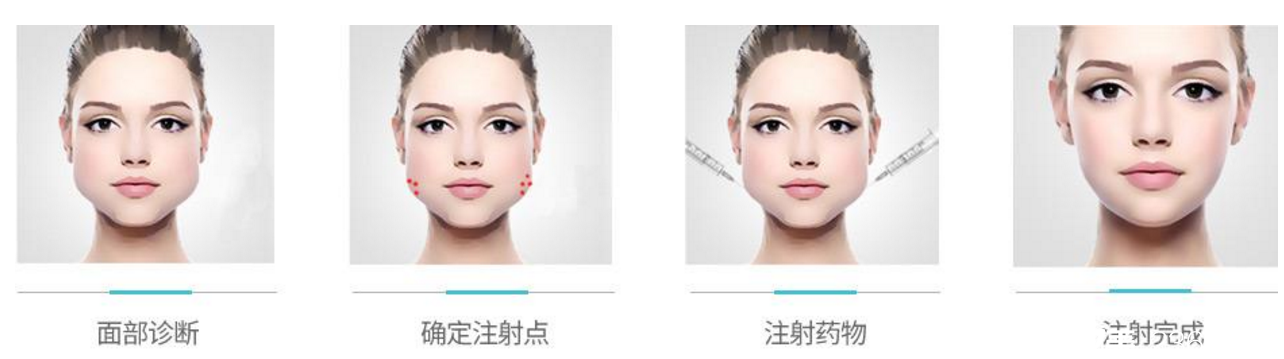 长沙爱思特打瘦脸价格