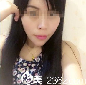 王新灿院长做硅胶假体垫下巴真人记录