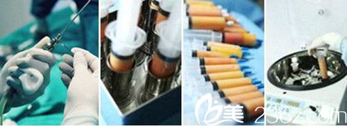 鲜活提炼脂肪技术