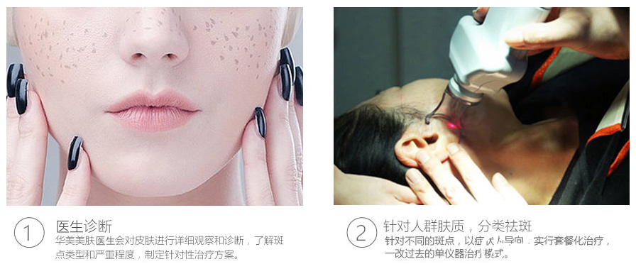 湛美何慧霞老年斑治疗过程 湛美何慧霞老年斑治疗过程