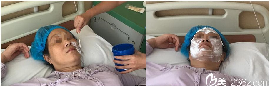 面部提升敷麻药过程 面部提升敷麻药过程