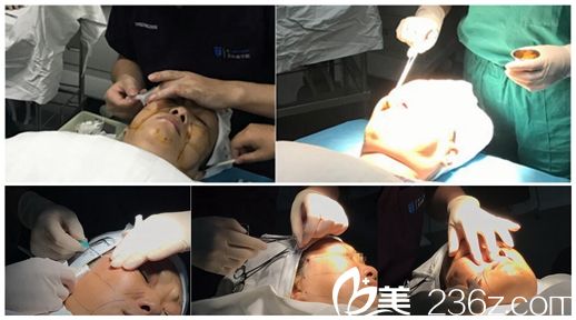 埋线提升消毒以及手术过程中 埋线提升消毒以及手术过程中