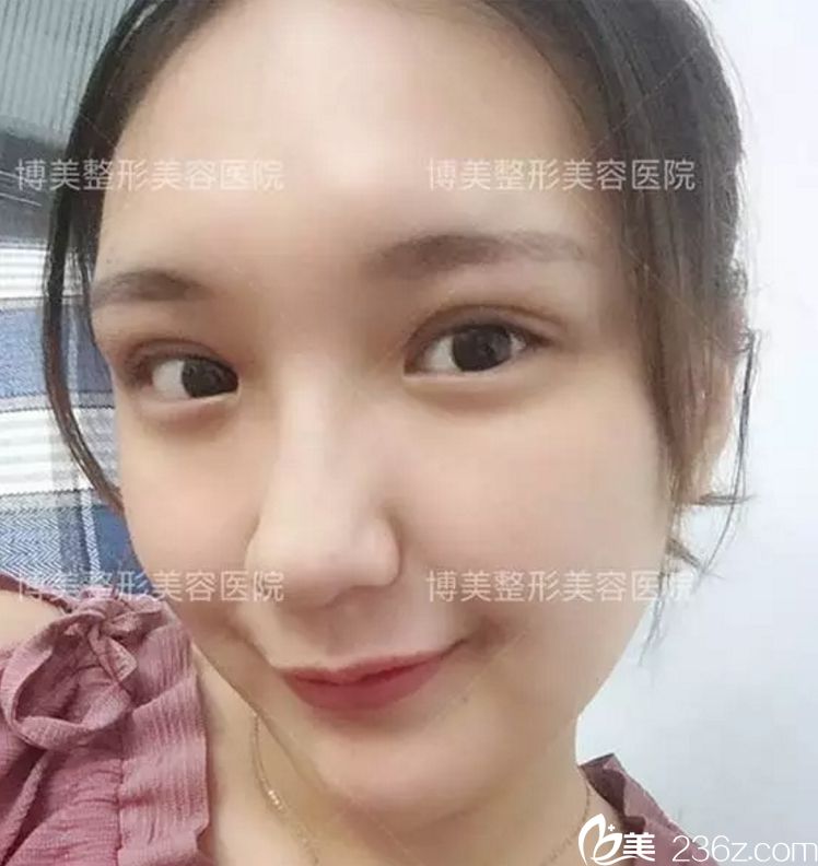 永州博美整形怎么样？永州博美整形做双眼皮怎么样？