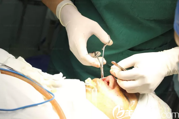 李希军院长鼻修复伤口缝合过程 李希军院长鼻修复伤口缝合过程