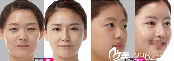 20171102_1509605904363983.png blob.png