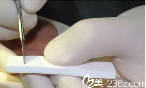 膨体雕刻 膨体隆鼻好还是硅胶 膨体雕刻 膨体隆鼻好还是硅胶