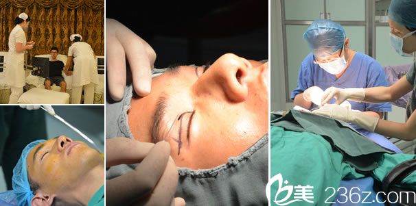 做双眼皮手术的过程图片