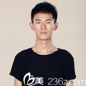 杭州维多利亚医疗美容医院刘中策术前照片1