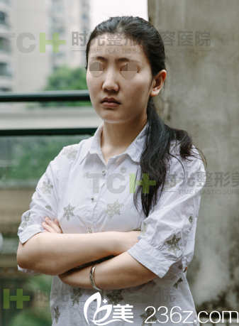 在重庆时光做DBM生态美弧隆鼻术前 在重庆时光做DBM生态美弧隆鼻术前