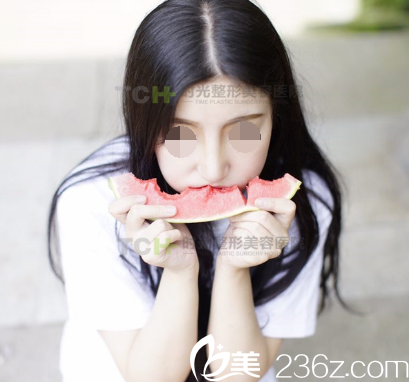 在重庆时光做DBM生态美弧隆鼻术后7天 在重庆时光做DBM生态美弧隆鼻术后7天