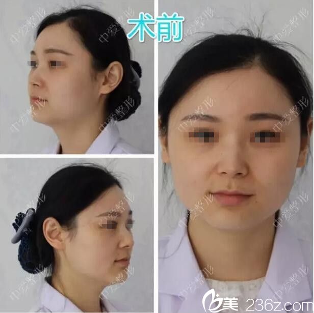 拍摄术前照片备案 拍摄术前照片备案