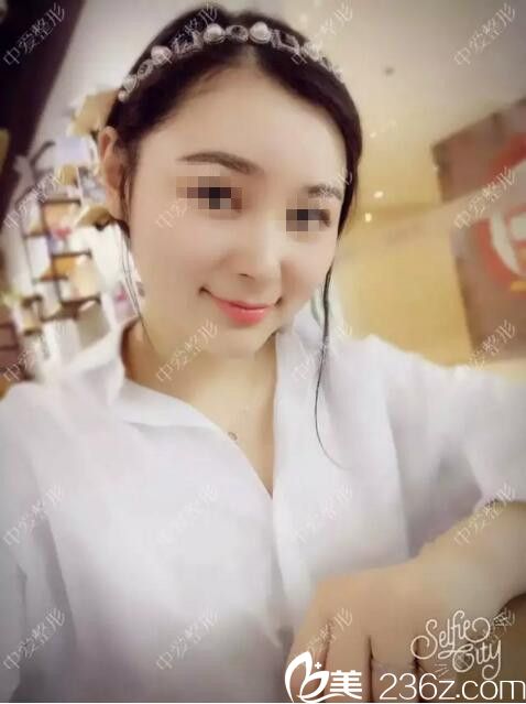 注射后第二天效果 注射后第二天效果