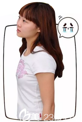 深圳美莱医疗美容医院郭杰术前照片1