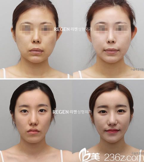 权锡玟院长的抗衰老案例图