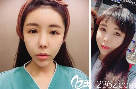 具贤国院长的抗衰老案例 具贤国院长的抗衰老案例