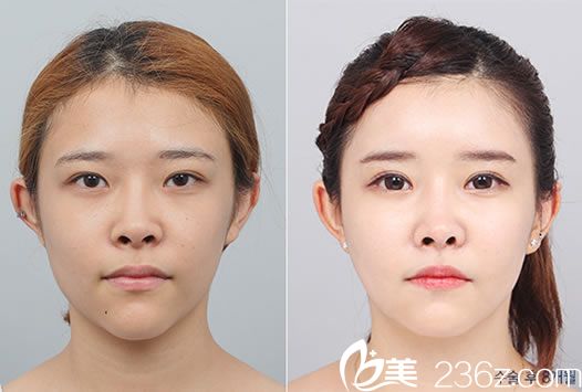 高一仙院长的皮肤抗衰案例图 高一仙院长的皮肤抗衰案例图