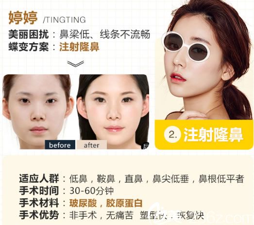 禾美注射隆鼻手术案例 禾美注射隆鼻手术案例