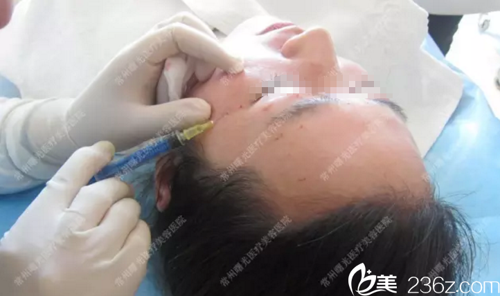 注射过程 注射过程