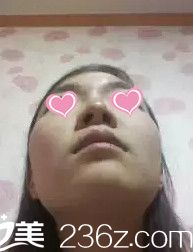 鼻子形态不好看 鼻子形态不好看