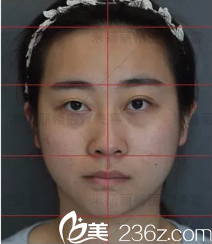 北京米扬丽格对求美者面部分析 北京米扬丽格对求美者面部分析