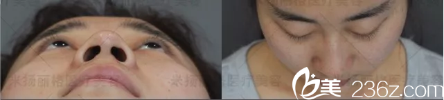 北京米扬丽格真人案例分析 北京米扬丽格真人案例分析