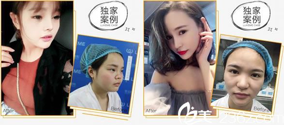 <!--<i data=20240703-sp></i>-->医生的鼻综合整形案例 <!--<i data=20240703-sp></i>-->医生的鼻综合整形案例