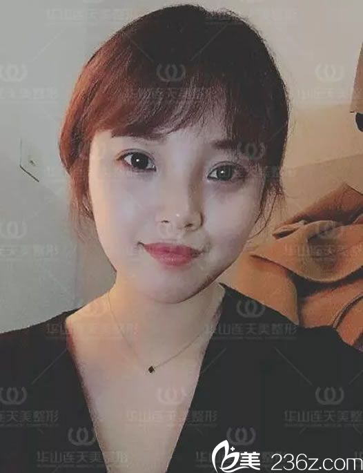 瘦脸一周的变化效果 瘦脸一周的变化效果