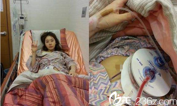 韩国没恩医院假体隆胸后无出血不需要血袋