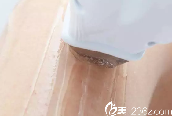 激光脱毛涂冷凝胶过程 激光脱毛涂冷凝胶过程