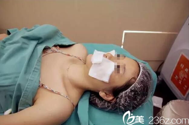 脱毛后皮肤需要冰敷 脱毛后皮肤需要冰敷